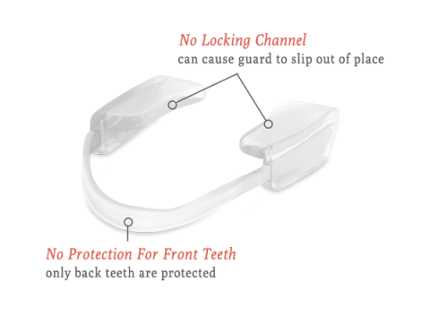 PARTIAL COVERAGE MOUTH GUARD
